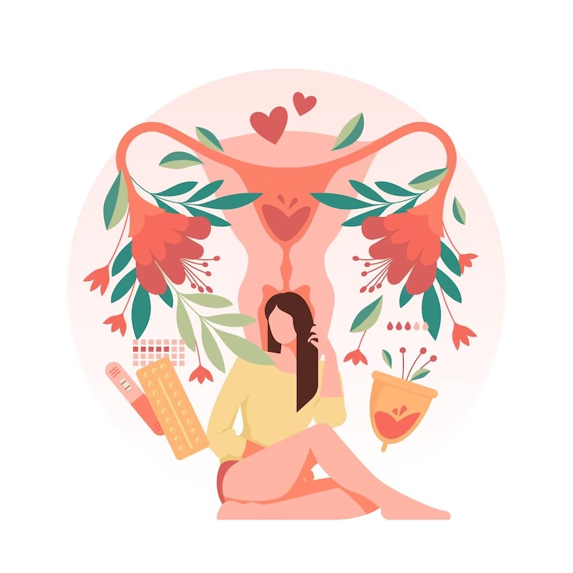 Ilustração de endometriose
