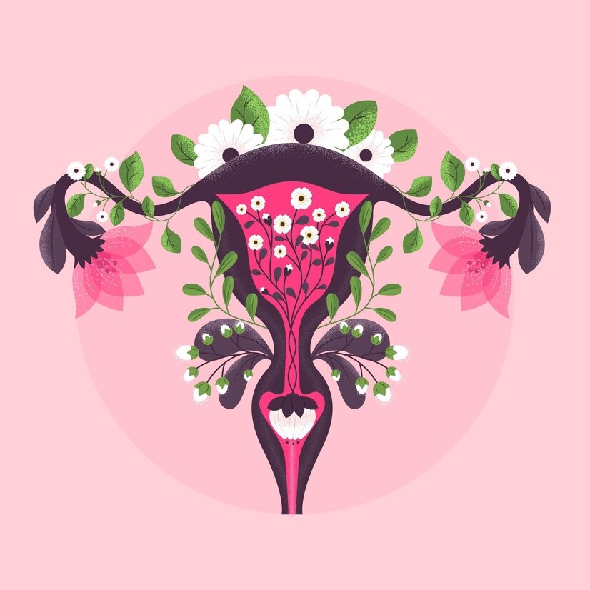 Ilustração de pólipo endometrial
