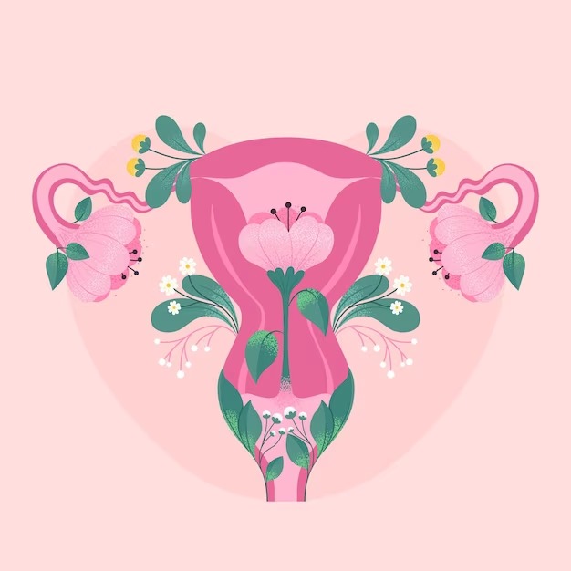 Ilustração de útero com miomas